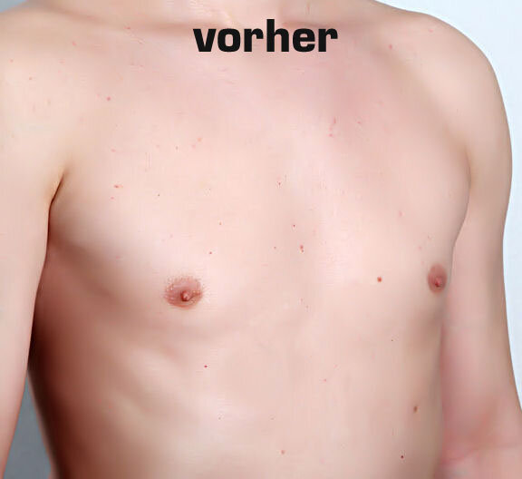 vorher 