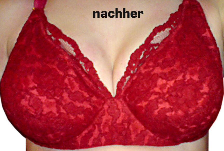 nachher